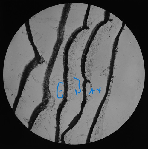 Microscope photo fungus - microscope,