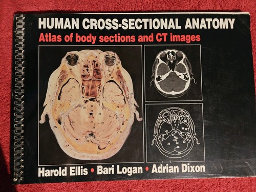 Human cross sectional anatomy - sectional,