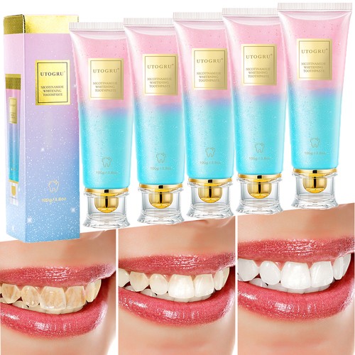 Niacinamide whitening - 5/3x,