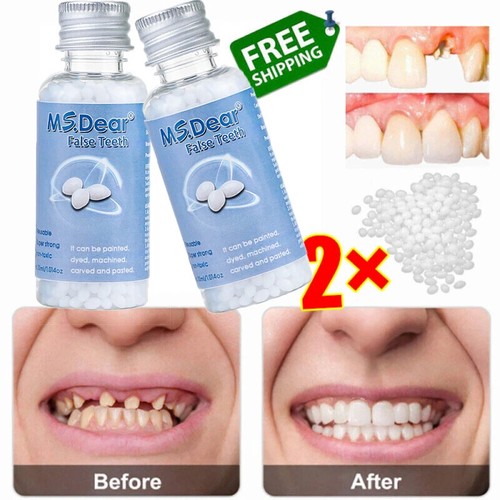 2pcs false teeth solid - 2pcs,