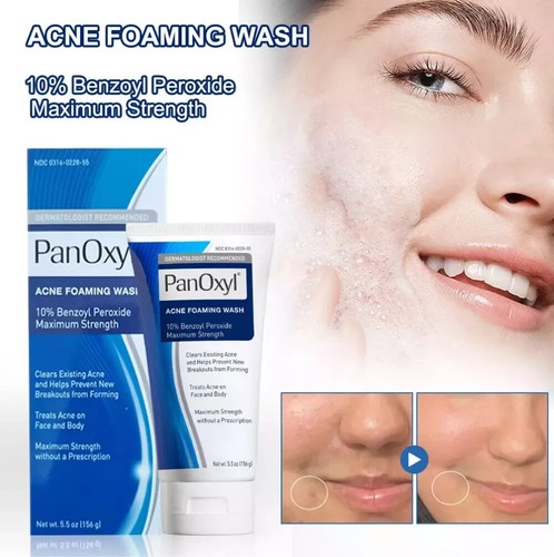 Acne foaming wash face - acne,