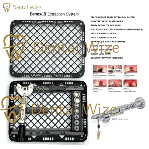 Benex dental extraction - benex,