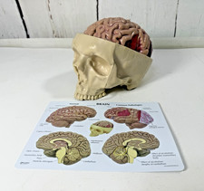 VTG 2001 GPI BRAIN MODEL 2900