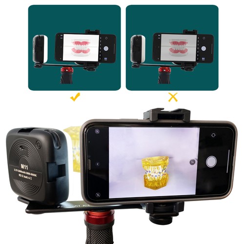 Dental mobile photography fill - photography,