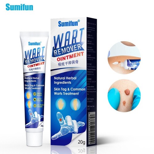 Wart removal treatment cream - removal,