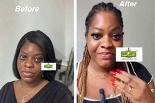 Skin Lightening Face Cream 