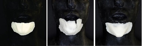 Prosthetic chin foam - prosthetic, latex