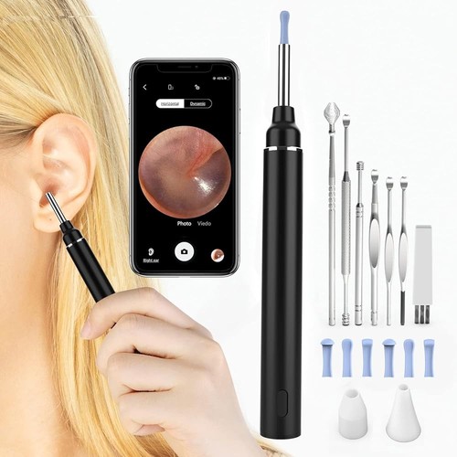Wireless ear removal tool wifi - removal,