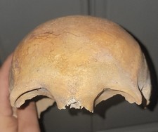 Antique Medical Anatomical Model Human Skull Study Oddity Bone Partial Gein Bowl