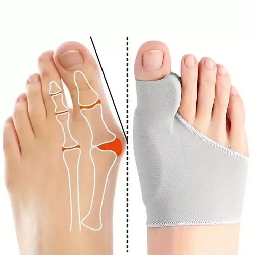 2pack bunion corrector hallux - 2pack,