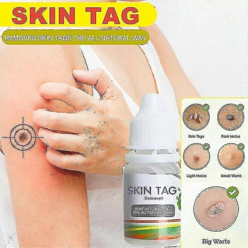 Crazylife skin tag remover - crazylife,