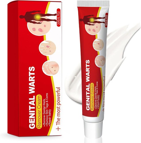 Strong skin tag remover - skin, cream