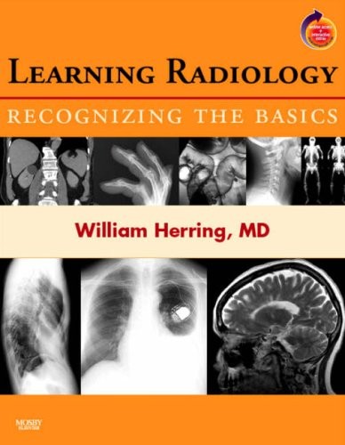 Learning radiology - learning,