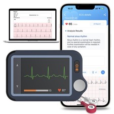 Touch Screen EKG Monitor Heart