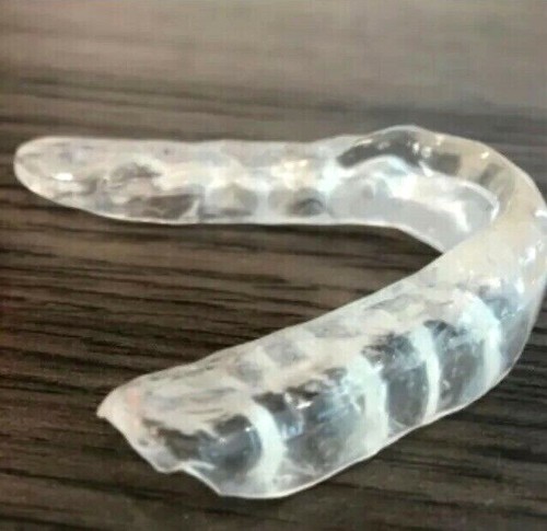 Custom fit teeth - teeth, grinding