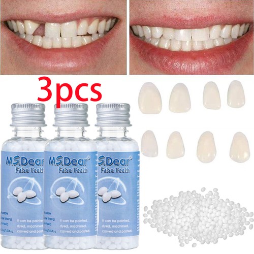 Tooth repair granules - tooth,