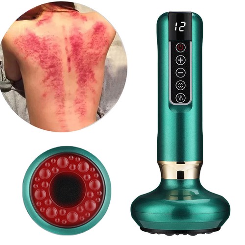 Levels electric cupping - 12,