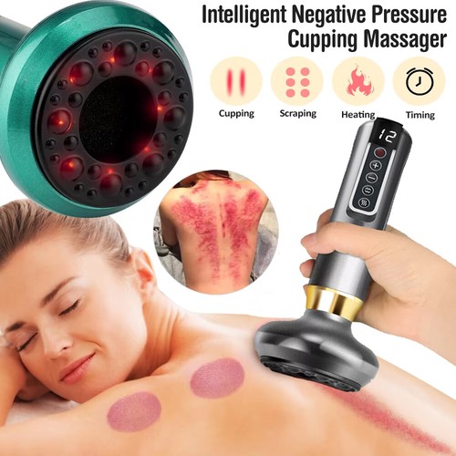 Electric vacuum cupping - electric,