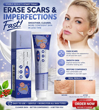 STRONG SKIN TAG REMOVER Cream