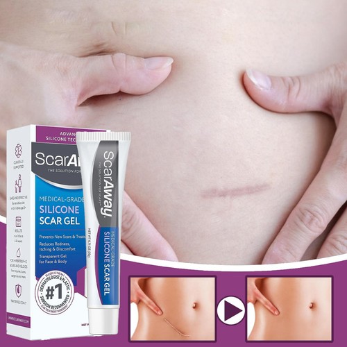 Scar away medical - scar,