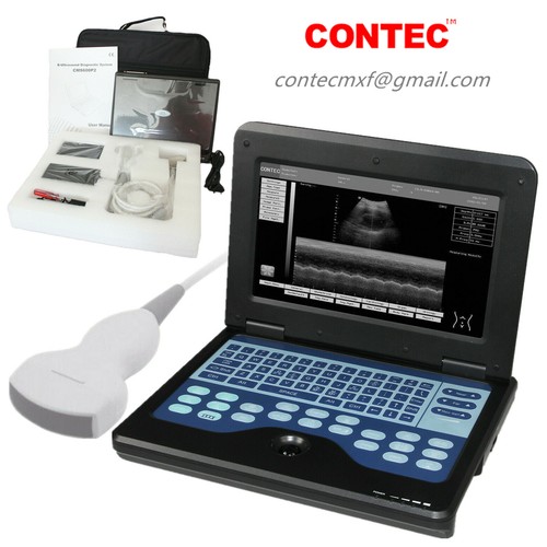 Cms600p2 ultrasound scanner - ultrasound,
