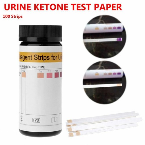 Ketone test strips - , urine