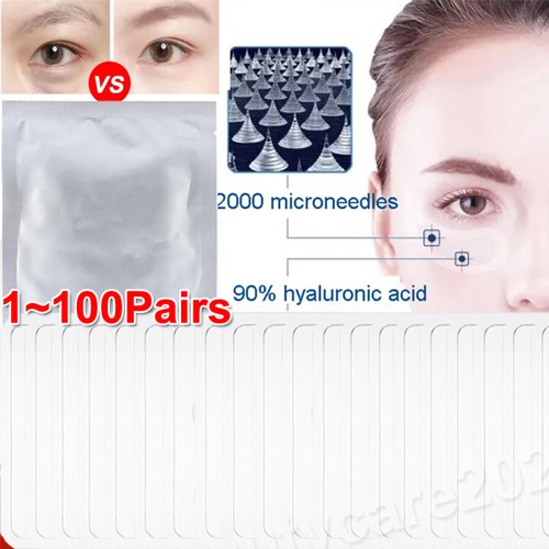 100 pairs micro needle - pairs, micro-needle
