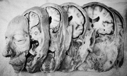 Antique human autopsy - antique, books