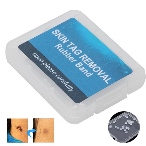 30pcs skin tag - skin, non