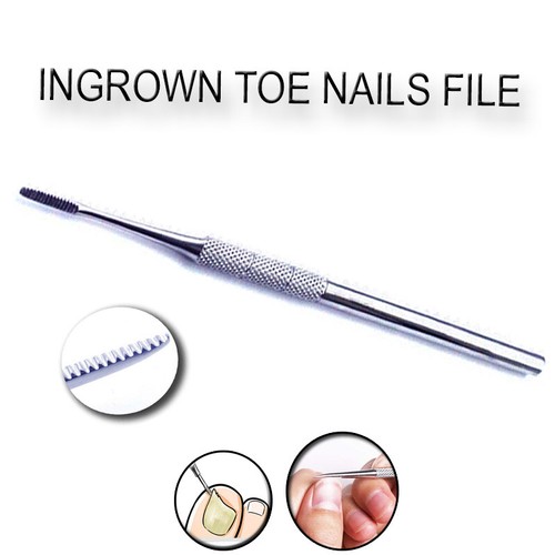 Ingrown toe nail black file - toe,