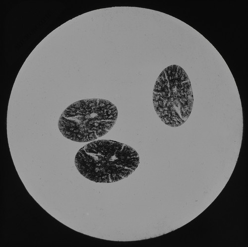 Microscope photo hair - microscope, of