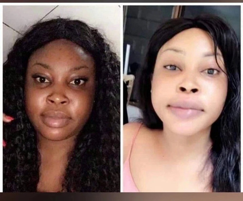 Best extreme whitening - 🥰,