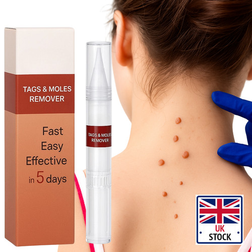 Wart remover liquid skin tag - liquid,