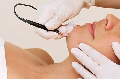 Accredited online epilation -  accredited,
