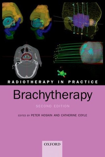 Radiotherapy practice - radiotherapy,