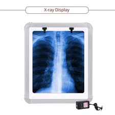 LED X-Ray Film Viewer Box SMALL(14''X17'') LARGE with free shipping