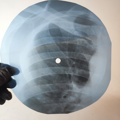 Four tops bernadette ray - tops, x-ray