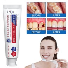 Upgrade Quick Repair of Cavities Caries Removal of Plaque Stains Toothpaste 120g