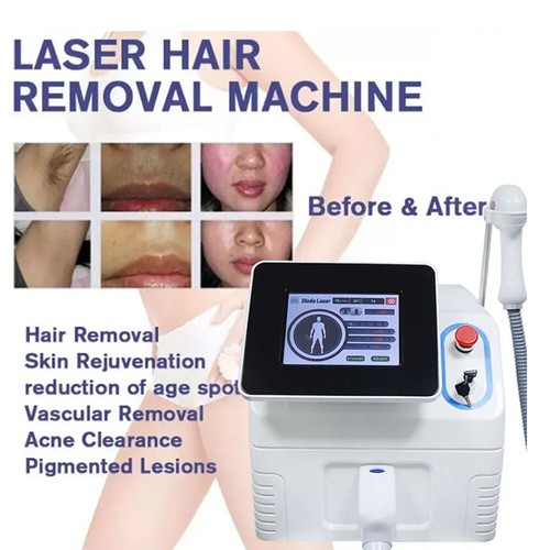 Diode laser 808nm painless - diode,