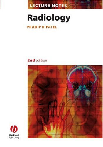 Lecture notes - lecture,