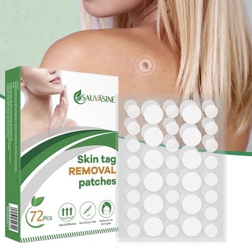New skin tag - new,