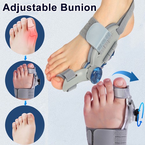 Nhs adjustable hallux valgus - nhs,