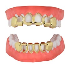 Open Face Teeth Custom Fit 14k