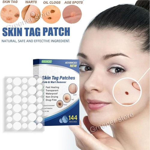 144pcs skin tag remover - 144pcs,