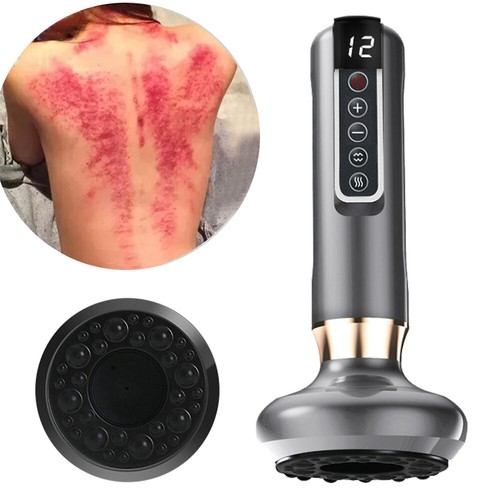 Electric cupping massager - electric,