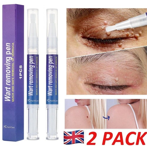 2pcs hours wart remover - 12,