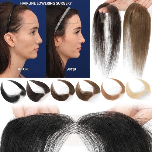 Women topper receding hairline - receding,