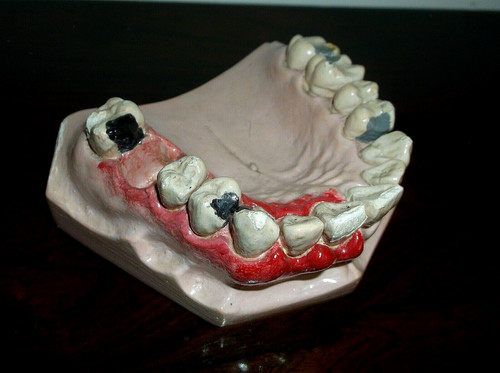 Rare antique anatomical - rare,