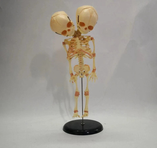 Fetal fetus skeleton - skeleton, teaching