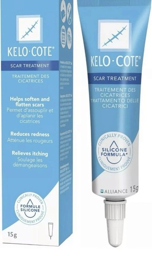 Kelo cote scar - kelo-cote, treatment